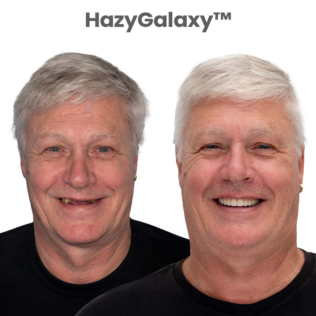💖 🦷 HazyGalaxy™ Custom-Fit Dentures ⏰ ENDS TODAY 70% OFF | Smile with Confidence