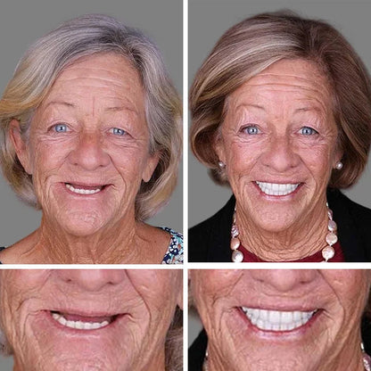 🌎Ends Today: 70% OFF! ⏰ Medical Full Denture with Strong Suctiond