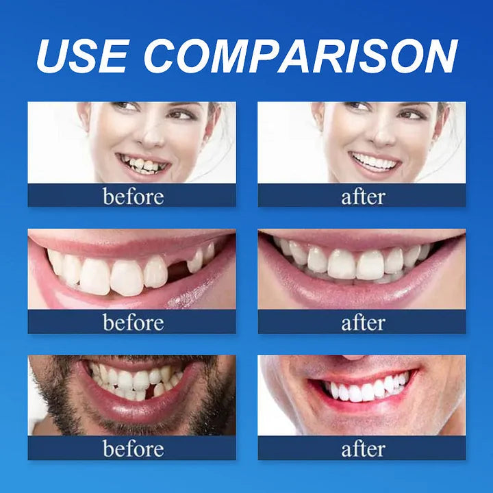 🦷𝐌𝐞𝐝𝐢𝐜𝐚𝐥-𝐆𝐫𝐚𝐝𝐞 𝐃𝐞𝐧𝐭𝐮𝐫𝐞𝐬 | 𝐍𝐚𝐭𝐮𝐫𝐚𝐥 𝐂𝐨𝐦𝐟𝐨𝐫𝐭 𝐅𝐢𝐭 𝐟𝐨𝐫 𝐈𝐧𝐬𝐭𝐚𝐧𝐭 𝐂𝐨𝐧𝐟𝐢𝐝𝐞𝐧𝐭 𝐒𝐦𝐢𝐥𝐞
