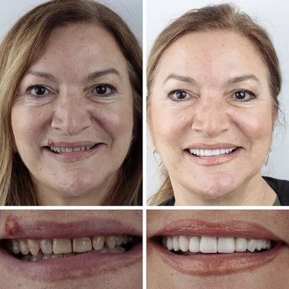 🦷𝐌𝐞𝐝𝐢𝐜𝐚𝐥-𝐆𝐫𝐚𝐝𝐞 𝐃𝐞𝐧𝐭𝐮𝐫𝐞𝐬 | 𝐍𝐚𝐭𝐮𝐫𝐚𝐥 𝐂𝐨𝐦𝐟𝐨𝐫𝐭 𝐅𝐢𝐭 𝐟𝐨𝐫 𝐈𝐧𝐬𝐭𝐚𝐧𝐭 𝐂𝐨𝐧𝐟𝐢𝐝𝐞𝐧𝐭 𝐒𝐦𝐢𝐥𝐞
