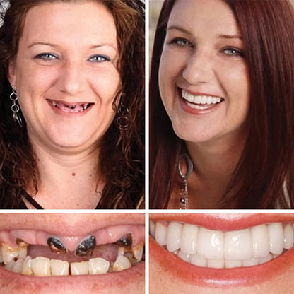 🦷𝐌𝐞𝐝𝐢𝐜𝐚𝐥-𝐆𝐫𝐚𝐝𝐞 𝐃𝐞𝐧𝐭𝐮𝐫𝐞𝐬 | 𝐍𝐚𝐭𝐮𝐫𝐚𝐥 𝐂𝐨𝐦𝐟𝐨𝐫𝐭 𝐅𝐢𝐭 𝐟𝐨𝐫 𝐈𝐧𝐬𝐭𝐚𝐧𝐭 𝐂𝐨𝐧𝐟𝐢𝐝𝐞𝐧𝐭 𝐒𝐦𝐢𝐥𝐞